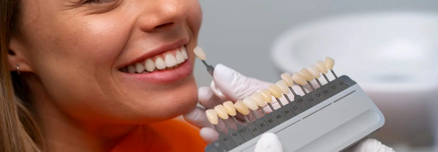 Dental Veneers Vancouver