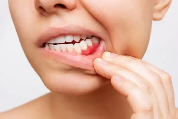 A woman showing her teeth and gums