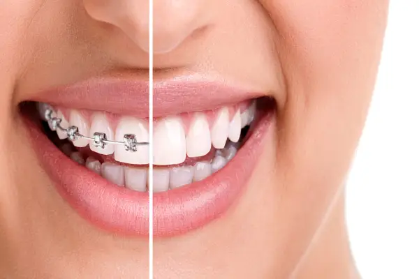 orthodontist vs cosmetic dentist