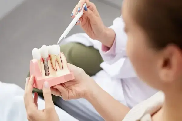 a dentist is showing teeth replica