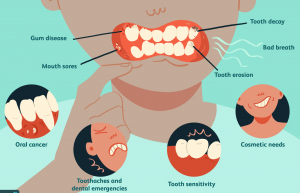 Common Dental Problems @vancouverDentist @dentistry @dentalimplant #dentistry #dentist #dentalimplant #meta @meta #DentistVancouver #burnabyDentist #dentistBurnaby #painlessDentist #GentleDentist #bestDentistVancouver @VancouverBestDentist #BurnabyBestDentist @bestDentistBurnaby @olympicVillageDentist @DentistOlympicVillage #OlympicVillageDental #DentistBurnaby #DentalImplant #CosmeticDentist #dentistry #DentistNearme #dentistNearHere #acceptdentalinsurance #dentalbenefit #affordableDentist