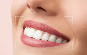 Boost Confidence Through Cosmetic Dental treatments. Missing tooth?  Your smile is the key to success in your social and professional life. #ChangeYourSmileChangeYourLife @ChangeYourSmileChangeYourLife  Dental implant maybe the easiest, most affordable and painless solution. Call today for Free consult 6045597270 @vancouverDentist @dentistry @dentalimplant 
