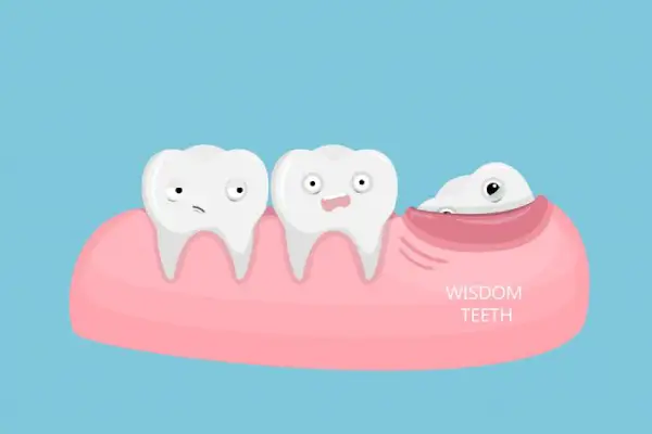 Photo of three teeth