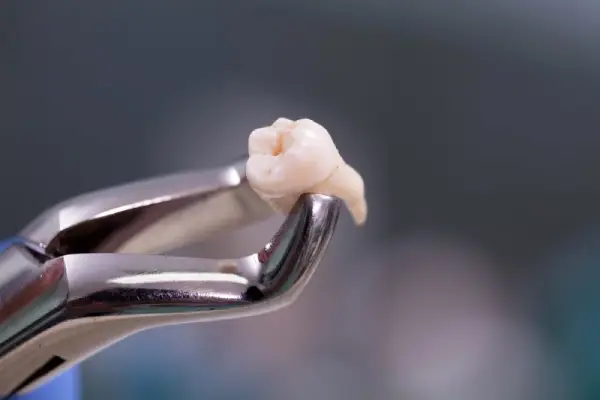 Tooth on dental forceps