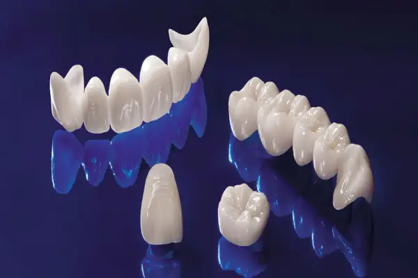 choose between crowns and veneers