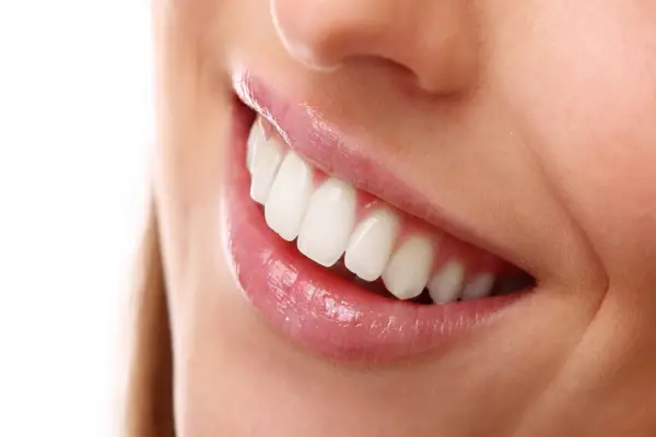 a woman with white teeth