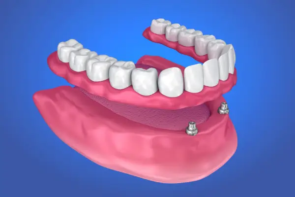 over denture with blue background