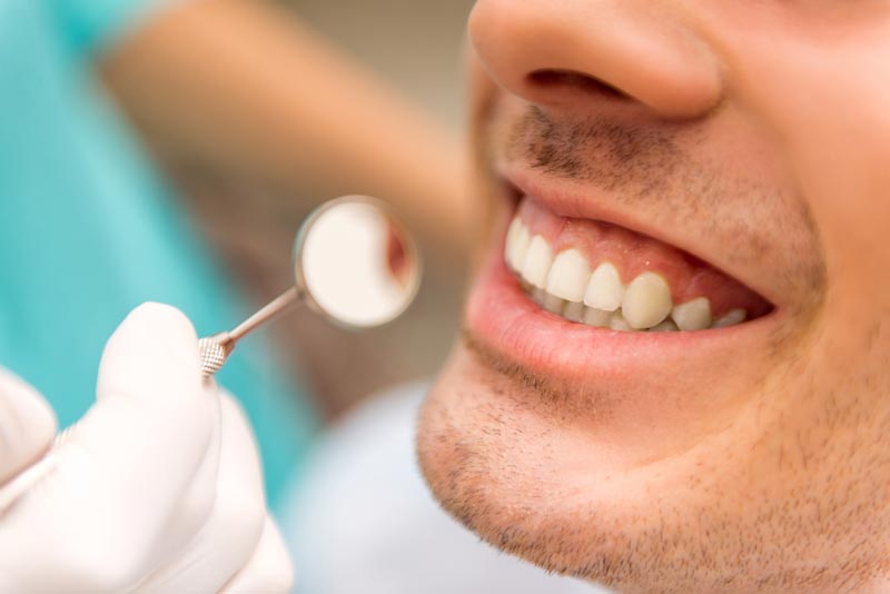 man with dental crowns treatment