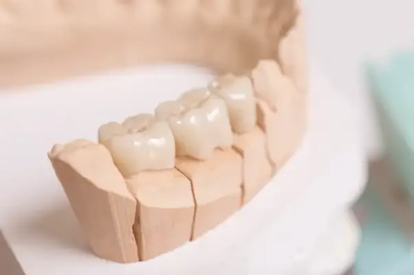 white teeth replica