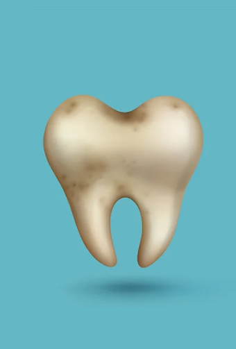 What Are the Early Signs That You May Need a Root Canal Treatment